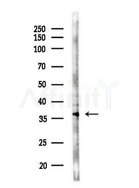 RALY Antibody - Western blot analysis of lysates from COLO205 cells(UV,30min treatment), using RALY Antibody at 1/1000 dilution.