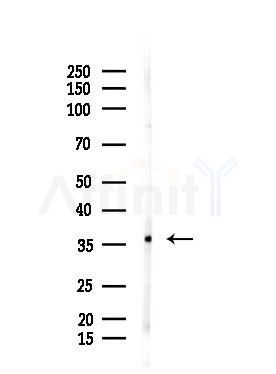 RALY Antibody - Western blot analysis of lysates from Raji cells(heat-shock,45min treatment), using RALY Antibody at 1/1000 dilution.