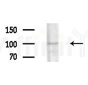 A20A1 Antibody - Western blot analysis of extracts from Hela cells, using A20A1 Antibody at 1/1000 dilution.
