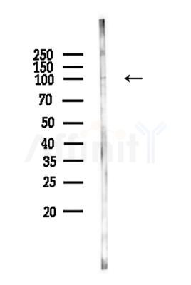 A20A1 Antibody - Western blot analysis of lysates from Hela cells, using A20A1 Antibody at 1/1000 dilution.