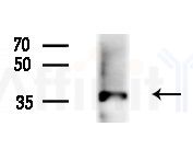 ZNF691 Antibody - Western blot analysis of extracts from HepG2 cells(LPS 4h treatment), using ZNF691 Antibody at 1/1000 dilution.