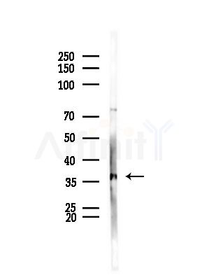 ZNF691 Antibody - Western blot analysis of lysates from HepG2 cells(LPS,4h treatment), using ZNF691 Antibody at 1/1000 dilution.