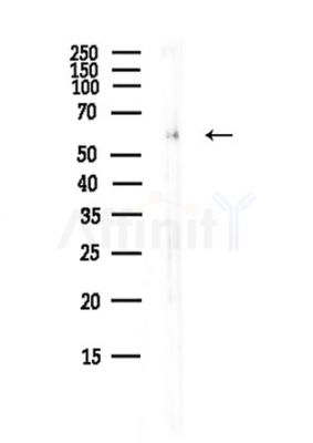 CREB3L2 Antibody - Western blot analysis of lysates from Mouse liver, using CREB3L2 Antibody at 1/1000 dilution.
