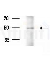ZNF329 Antibody - Western blot analysis of extracts from 293 cells(starvation treatment), using ZNF329 Antibody at 1/1000 dilution.
