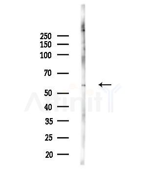 ZNF329 Antibody - Western blot analysis of lysates from 293 cells(starvation,24h treatment), using ZNF329 Antibody at 1/1000 dilution.