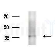 OSR2 Antibody - Western blot analysis of extracts from Mouse liver, using OSR2 Antibody at 1/1000 dilution.
