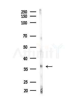 OSR2 Antibody - Western blot analysis of lysates from Mouse liver, using OSR2 Antibody at 1/1000 dilution.