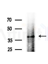 SLC38A2 Antibody - Western blot analysis of lysates from Hela cells(heat-shock,45min treatment), using SLC38A2 Antibody at 1/1000 dilution.