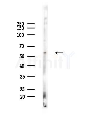 ARX Antibody - Western blot analysis of lysates from COLO205 cells(heat-shock,45min treatment), using ARX Antibody at 1/1000 dilution.