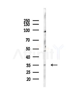 SPON2 Antibody - Western blot analysis of lysates from LoVo cells(heat-shock,45min treatment), using SPON2 Antibody at 1/1000 dilution.