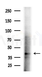 ZNF446 Antibody - Western blot analysis of extracts from B16F10-LUC cells(starvation,24h treatment), using ZNF446 Antibody at 1/1000 dilution.