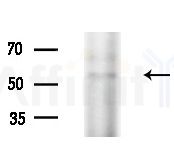 PLAGL1 Antibody - Western blot analysis of extracts from PC12 cells(starvation treatment), using PLAGL1 Antibody at 1/1000 dilution.