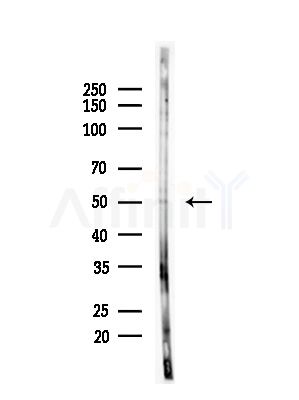 PLAGL1 Antibody - Western blot analysis of lysates from PC12 cells(starvation,24h treatment), using PLAGL1 Antibody at 1/1000 dilution.