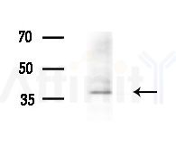 STARD10 Antibody - Western blot analysis of extracts from Rat brain, using STARD10 Antibody at 1/1000 dilution.