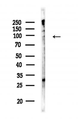 DGKB Antibody - Western blot analysis of lysates from HUVEC cells, using DGKB Antibody at 1/1000 dilution.