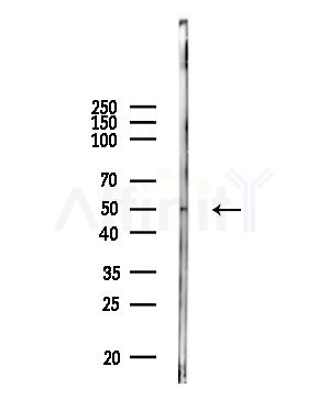 IL13RA2 Antibody - Western blot analysis of lysates from Mouse lung, using IL13RA2 Antibody at 1/1000 dilution.