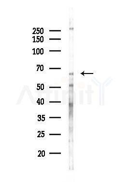 IL18R1 Antibody - Western blot analysis of lysates from Hela cells(heat-shock,45min treatment), using IL18R1 Antibody at 1/1000 dilution.