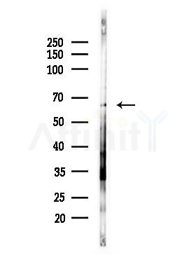 IL18R1 Antibody - Western blot analysis of lysates from RAW264.