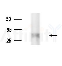 MOX2R Antibody - Western blot analysis of extracts from B16F10-LUC cells(starvation,24h treatment), using MOX2R Antibody at 1/1000 dilution.