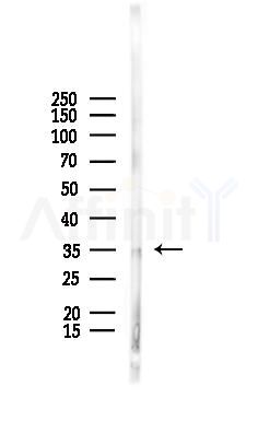 MOX2R Antibody - Western blot analysis of lysates from B16F10-LUC cells(starvation,24h treatment), using MOX2R Antibody at 1/1000 dilution.