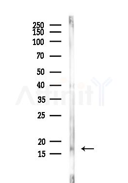 MYL6 Antibody - Western blot analysis of lysates from Rat liver, using MYL6 Antibody at 1/1000 dilution.