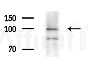 PLA2G6 Antibody - Western blot analysis of lysates from HepG2 cells(LPS 4h treatment), using PLA2G6 Antibody at 1/1000 dilution.