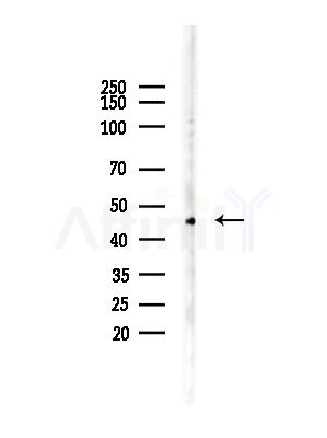 SUV39H2 Antibody - Western blot analysis of lysates from LoVo cells(heat-shock,45min treatment), using SUV39H2 Antibody at 1/1000 dilution.
