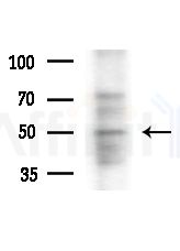 TAIP-12 Antibody - Western blot analysis of extracts from HepG2 cells, using TAIP-12 Antibody at 1/1000 dilution.