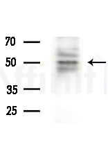 TAIP-12 Antibody - Western blot analysis of extracts from 293 cells(starvation treatment), using TAIP-12 Antibody at 1/1000 dilution.