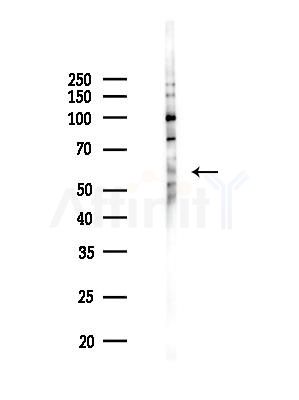 TAIP-12 Antibody - Western blot analysis of lysates from 293 cells(starvation,24h treatment), using TAIP-12 Antibody at 1/1000 dilution.