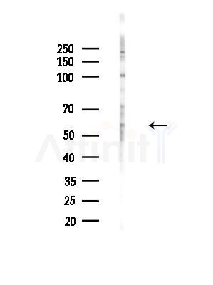 TAIP-12 Antibody - Western blot analysis of lysates from HepG2 cells, using TAIP-12 Antibody at 1/1000 dilution.