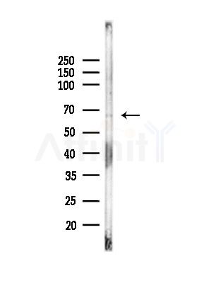 TAIP-2 Antibody - Western blot analysis of lysates from MCF7 cells(heat-shock,45min treatment), using TAIP-2 Antibody at 1/1000 dilution.