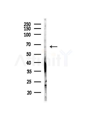 TAIP-2 Antibody - Western blot analysis of lysates from Rat testis, using TAIP-2 Antibody at 1/1000 dilution.