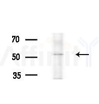 TRAF4 Antibody - Western blot analysis of extracts from EC304 cells
(heat-shock treatment), using TRAF4 Antibody at 1/1000 dilution.