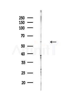 TRAF4 Antibody - Western blot analysis of lysates from EC304 cells(heat-shock treatment), using TRAF4 Antibody at 1/1000 dilution.