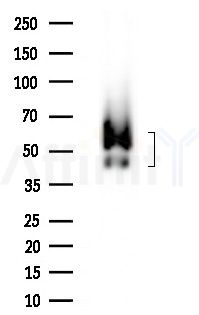 ZAR1 Antibody - Western blot analysis of extracts from Rat brain, using ZAR1 Antibody at 1/1000 dilution.