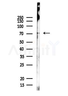 CHFR Antibody - Western blot analysis of lysates from Rat liver, using CHFR Antibody at 1/1000 dilution.
