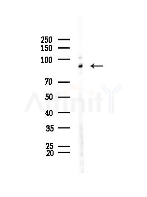 TOP1 Antibody - Western blot analysis of lysates from HepG2 cells(LPS,4h treatment), using TOP1 Antibody at 1/1000 dilution.