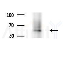 Cytochrome P450 4V2 Antibody - Western blot analysis of lysates from Mouse liver, using Cytochrome P450 4V2 Antibody at 1/1000 dilution.