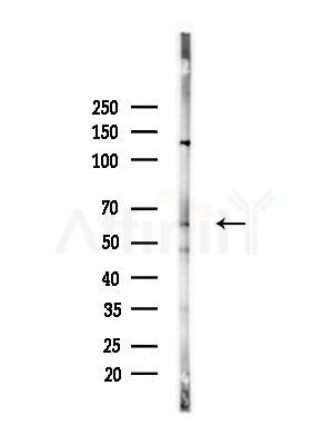 Cytochrome P450 4V2 Antibody - Western blot analysis of lysates from Mouse liver, using Cytochrome P450 4V2 Antibody at 1/1000 dilution.