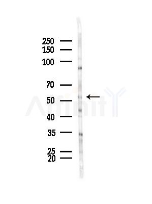 Cytochrome P450 39A1 Antibody - Western blot analysis of lysates from HepG2 cells(LPS,4h treatment), using Cytochrome P450 39A1 Antibody at 1/1000 dilution.