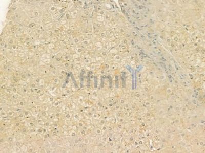Cytochrome P450 39A1 Antibody - DF4761 at 1/100 staining human normal liver tissue by IHC-P.