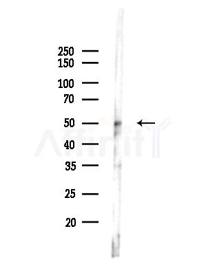 KCNJ4 Antibody - Western blot analysis of lysates from MCF7 cells(heat-shock,45min treatment), using KCNJ4 Antibody at 1/1000 dilution.