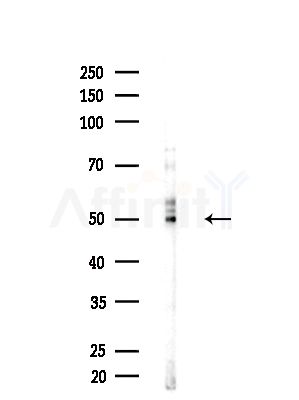KCNJ4 Antibody - Western blot analysis of lysates from A375 cells(heat-shock,45min treatment), using KCNJ4 Antibody at 1/1000 dilution.