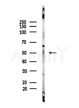 MAGEC2 Antibody - Western blot analysis of lysates from Mouse brain, using MAGEC2 Antibody at 1/1000 dilution.