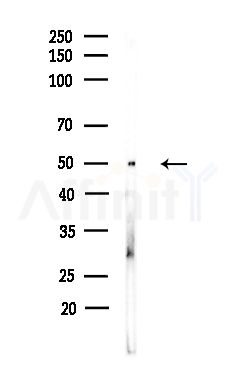 Casein Kinase 1 delta Antibody - Western blot analysis of lysates from Hela cells(heat-shock,45min treatment), using Casein Kinase 1 delta Antibody at 1/1000 dilution.
