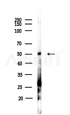 Casein Kinase 1 delta Antibody - Western blot analysis of lysates from MCF7 cells(heat-shock,45min treatment), using Casein Kinase 1 delta Antibody at 1/1000 dilution.