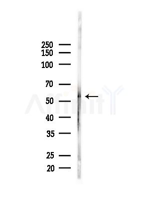 MATK Antibody - Western blot analysis of lysates from PC12 cells(starvation,24h treatment), using MATK Antibody at 1/1000 dilution.