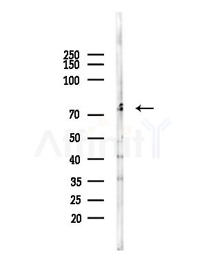 HUNK Antibody - Western blot analysis of lysates from LoVo cells(heat-shock,45min treatment), using HUNK Antibody at 1/1000 dilution.
