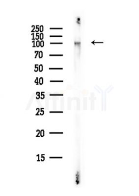 MERTK Antibody - Western blot analysis of lysates from Mouse liver, using MERTK Antibody at 1/1000 dilution.